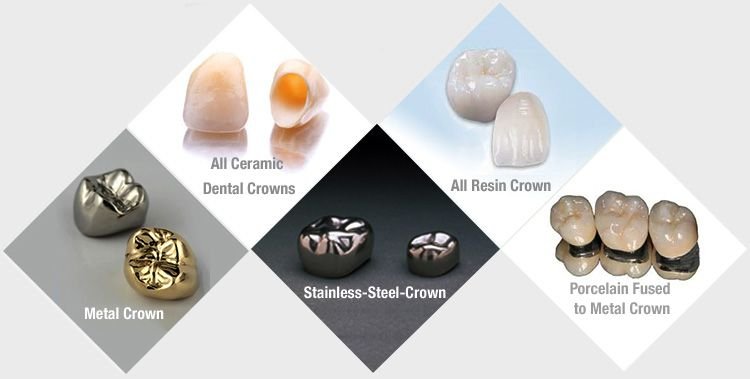 dental crown